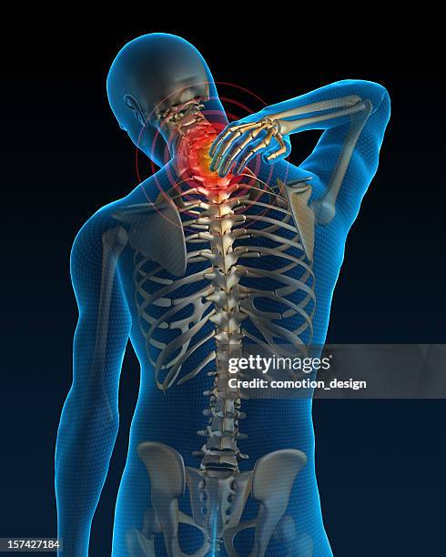 dor no pescoço - coluna vertebral humana imagens e fotografias de stock