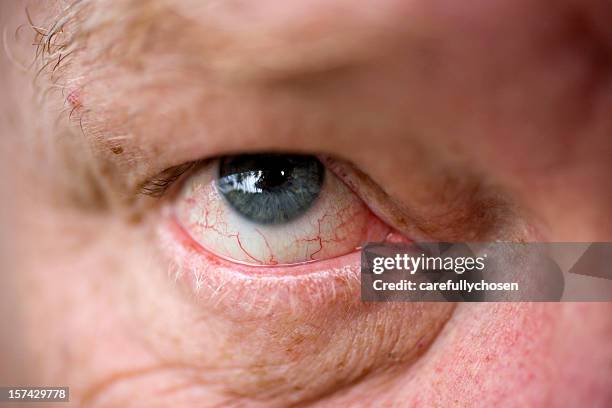 close up blood shot eye - red eyes stock pictures, royalty-free photos & images