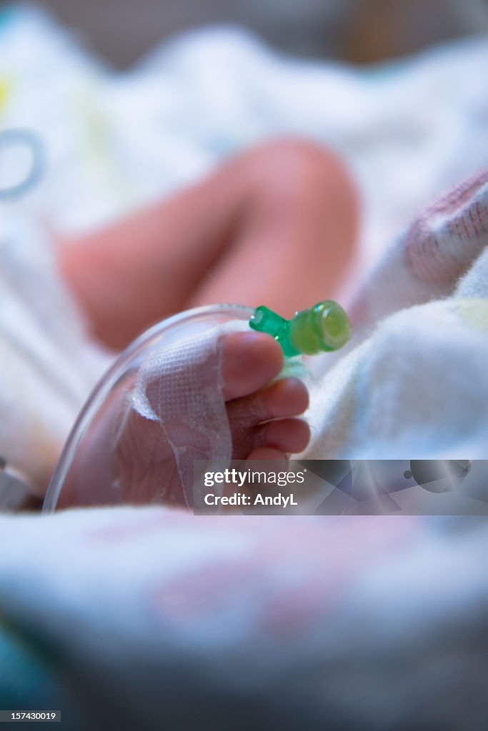 I bambini prematuri piede con IV