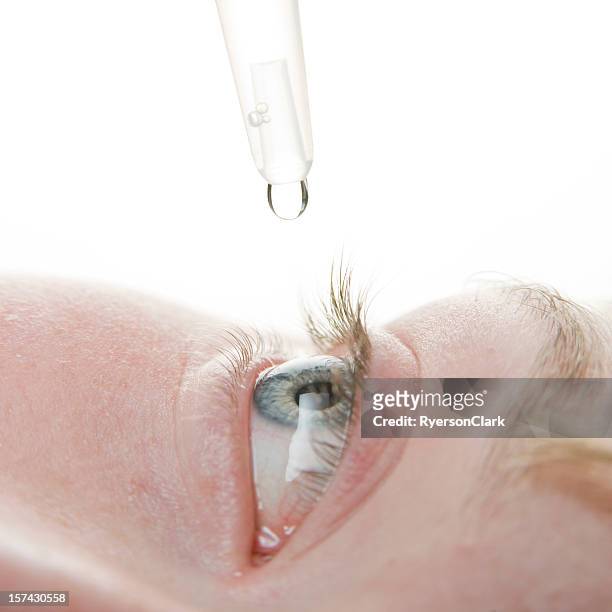 eye drops administered to a blue eye. - eyedropper bildbanksfoton och bilder