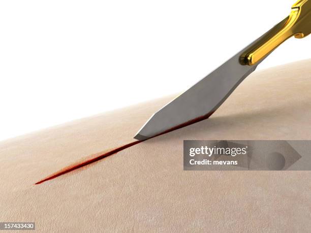 operation - autopsie stock-fotos und bilder