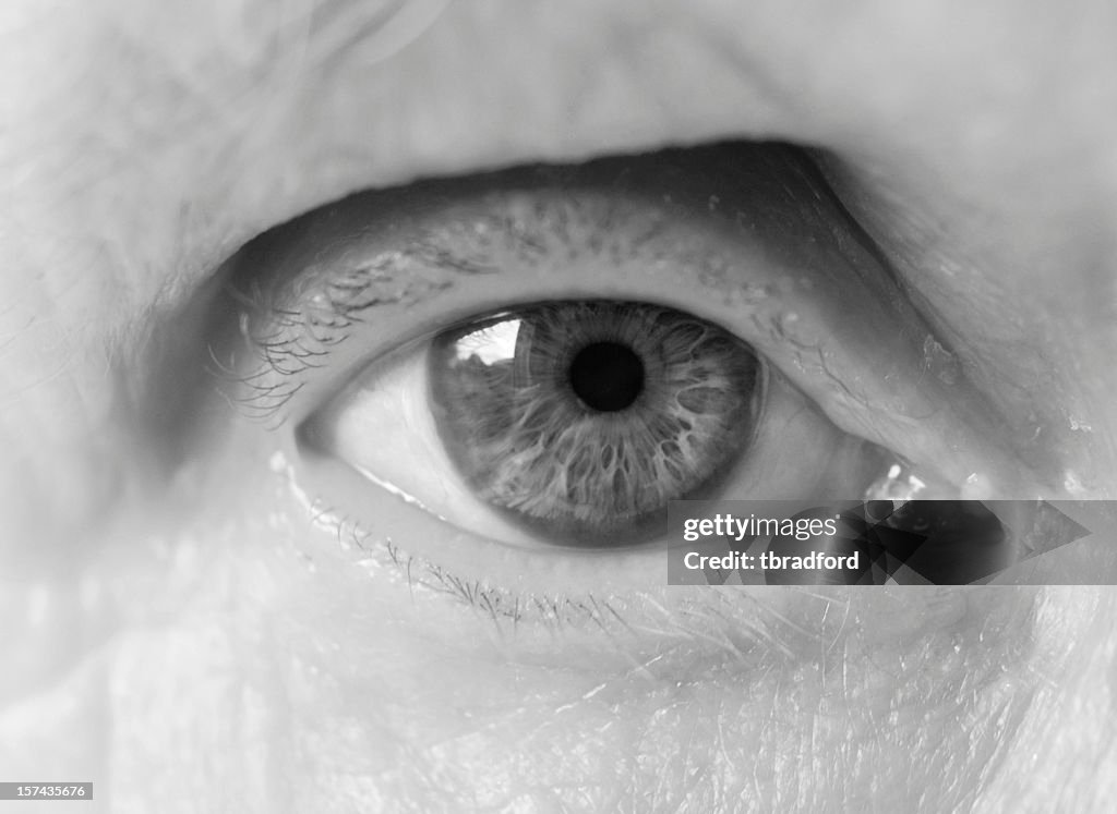 Elderly Womans Right Eye