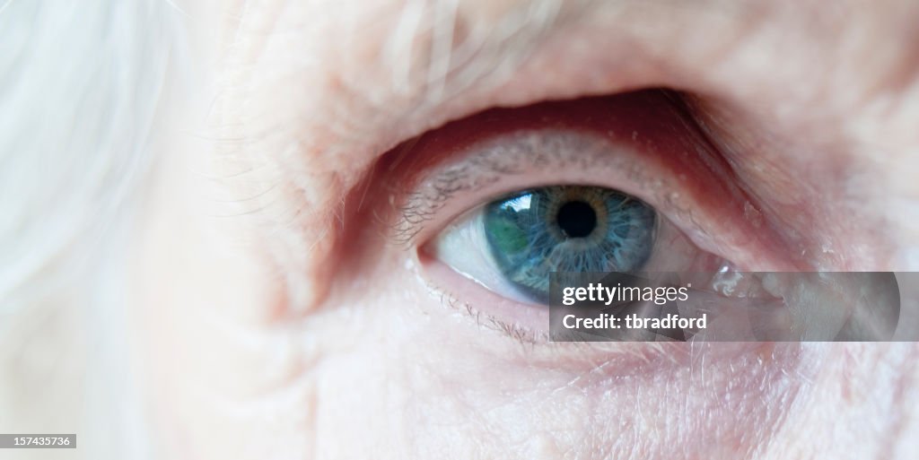 Elderly Womans Blue Eye