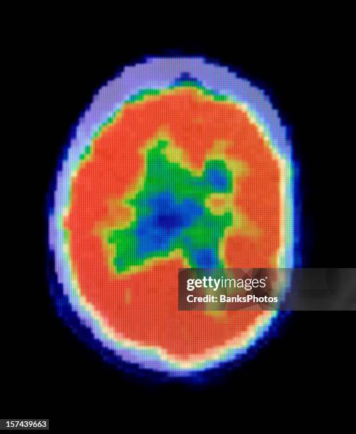 human brain pet scan - pet scan stock pictures, royalty-free photos & images