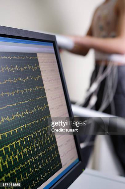 cardiac stress test - stress test stock pictures, royalty-free photos & images
