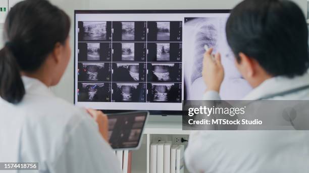medical team asian male and female doctors medical checking x-ray image of patient on computer discussing result meeting in hospital. medical health care. - lunga bildbanksfoton och bilder