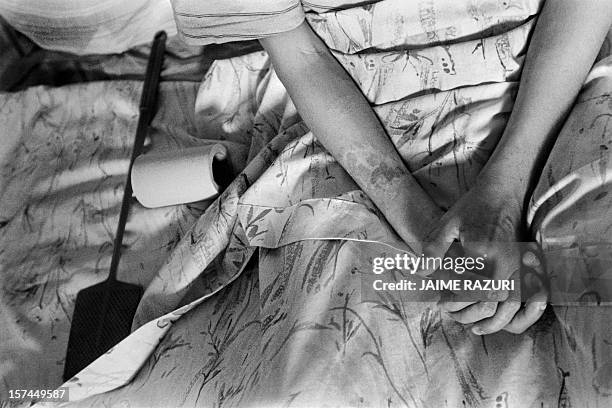 In this picture from January 1995 Andres, HIV positive, stays resting in his bed. The anti-retroviral medicine started to be distributed freely on...