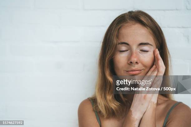 high angle view of beautiful young woman with vitiligo on skin sitting on floor - huidaandoening stockfoto's en -beelden