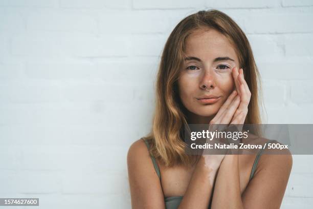 high angle view of beautiful young woman with vitiligo on skin sitting on floor - vitiligo stock-fotos und bilder