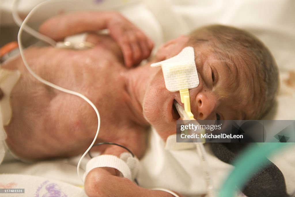 Niño bebé prematuro