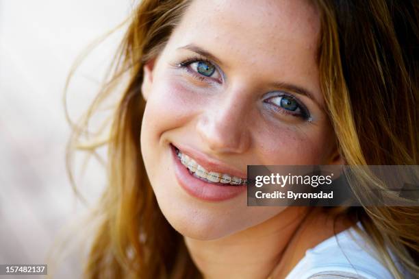 ragazza adolescente sorridente con bretelle - apparecchio ortodontico foto e immagini stock