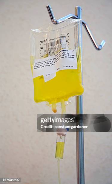 nutritional vitamin c intravenous drip - iv bag stock pictures, royalty-free photos & images