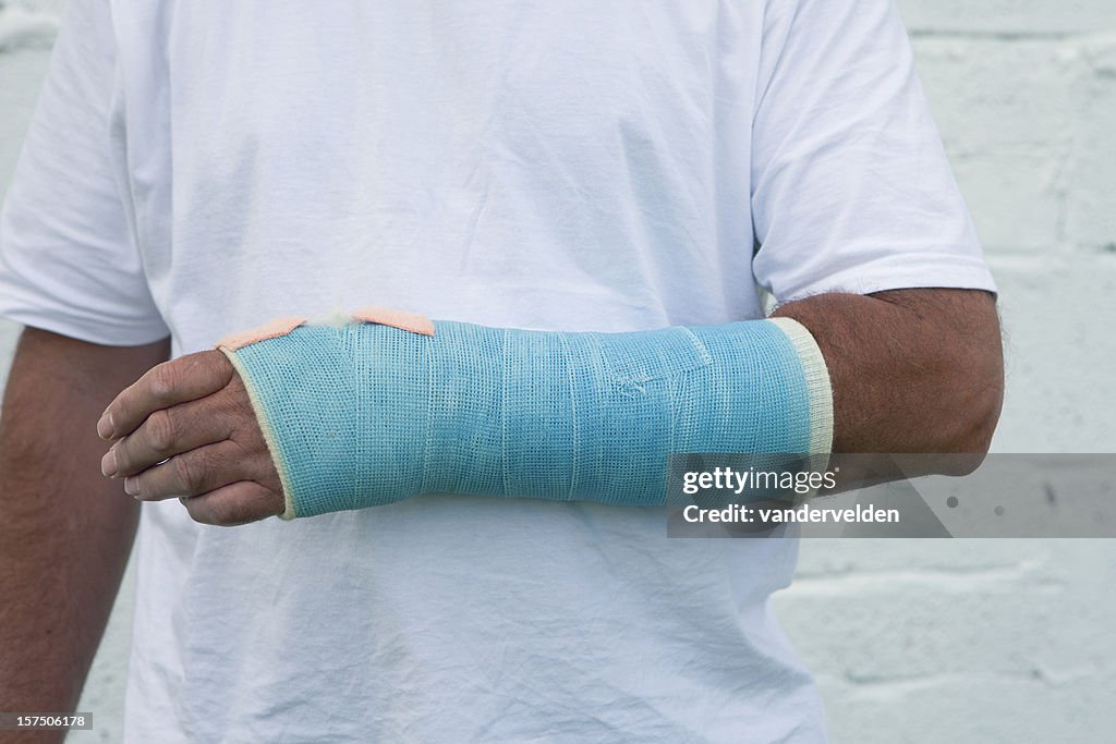 Man With A Broken Wrist