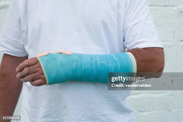 man with a broken wrist - broken arm stock pictures, royalty-free photos & images