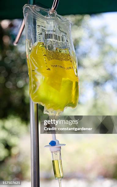 vitamin c intravenous drip - alternative therapy stock pictures, royalty-free photos & images