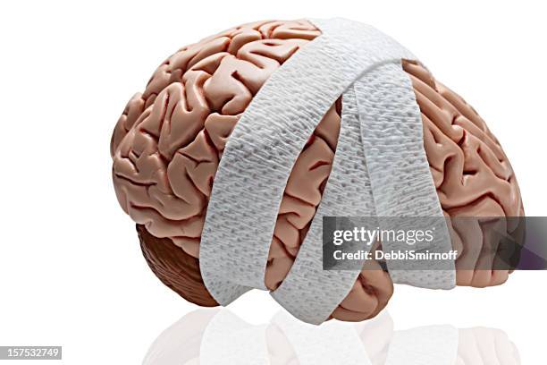 brain injury - concussion stock pictures, royalty-free photos & images