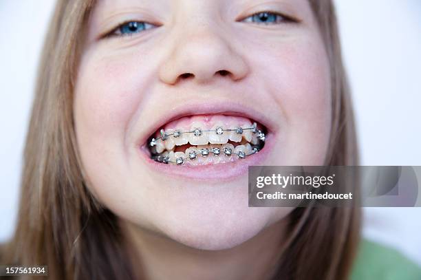 closeup on little girl's face showing her braces,  horizontal. - teeth braces stock pictures, royalty-free photos & images