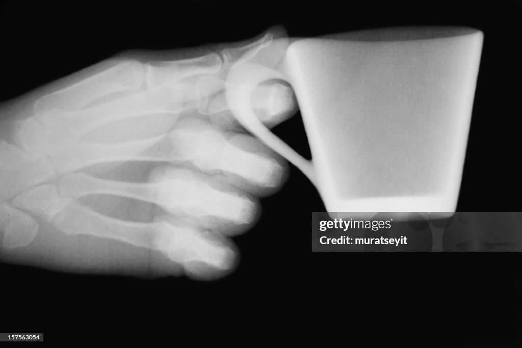 X-ray image with a hand and cup of coffee XXXL