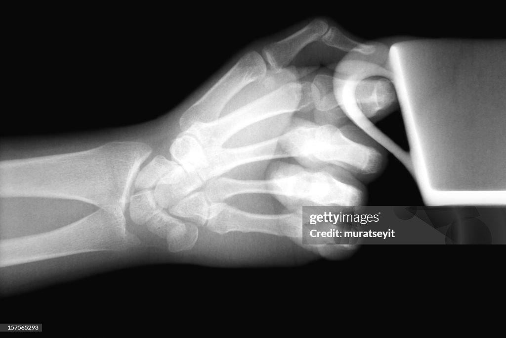 X-ray image with a hand and cup of coffee XXXL