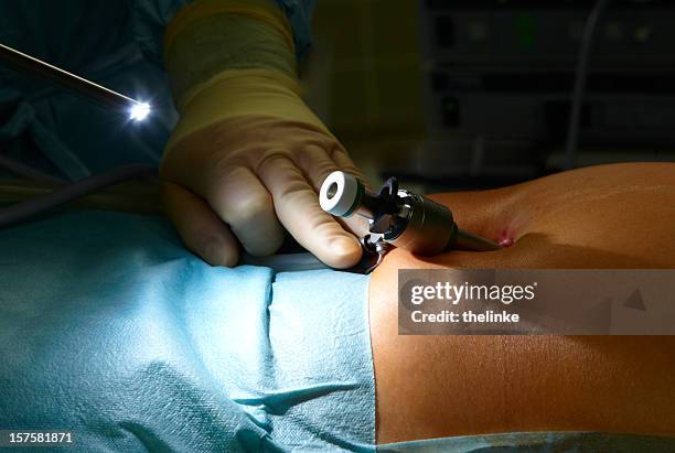 vorbereitung eines laparoskopische chirurgie - laparoskopische-chirurgie stock-fotos und bilder