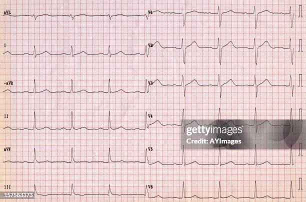 ecg background - medical research paper stock pictures, royalty-free photos & images