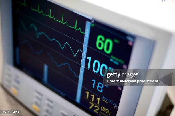 ekg hospital medical equipment vital statistics - medische apparatuur stockfoto's en -beelden