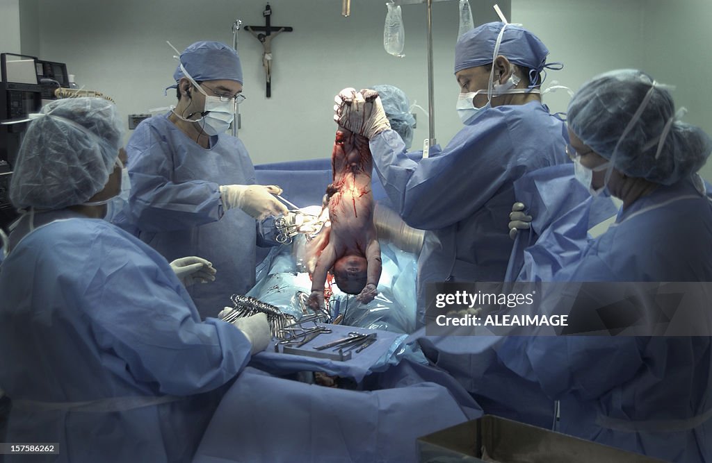 Caesarean birth