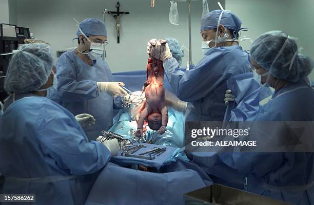 caesarean birth - c section stock pictures, royalty-free photos & images