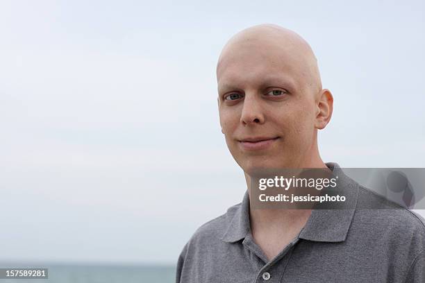 happy chemo cancer patient - completely bald stockfoto's en -beelden