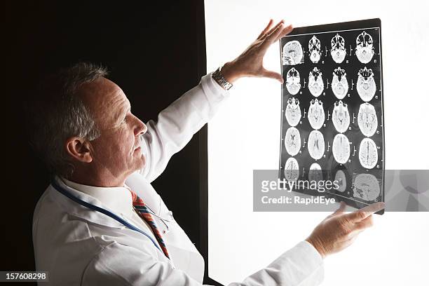 doctor looks at brain scan images on lightbox - light box stock pictures, royalty-free photos & images