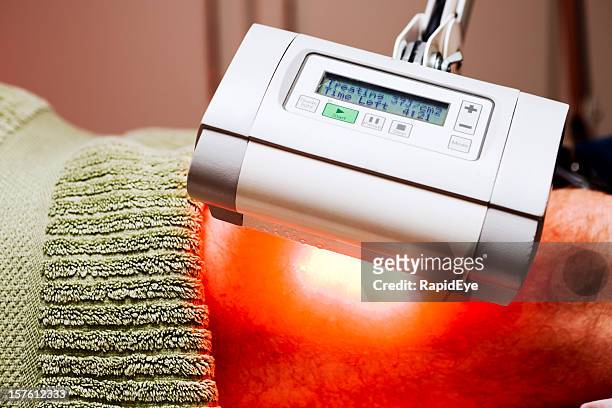 photodynamic therapy (pdt) treating skin cancer on leg - alternative therapy stock pictures, royalty-free photos & images