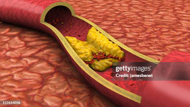 clogged artery low angle view (3d) - cholesterol stockfoto's en -beelden