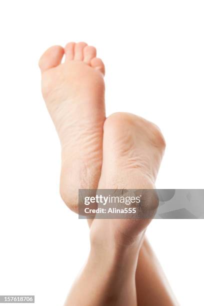 dry and cracked soles of feet on white background - human foot stock pictures, royalty-free photos & images