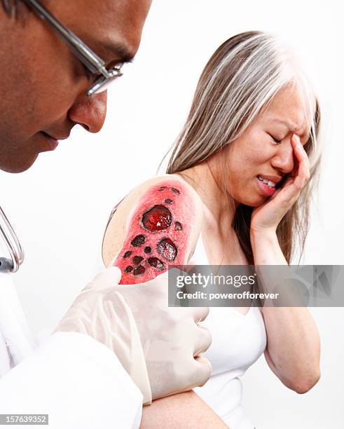 doctor examining burn on patient - arm pain stock pictures, royalty-free photos & images