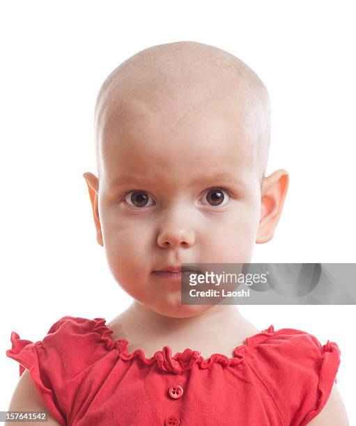 a young bald girl wearing a red dress - bald girl stock pictures, royalty-free photos & images
