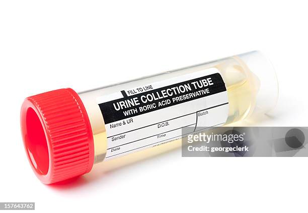 muestra de orina - urine sample fotografías e imágenes de stock