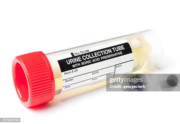 urine sample - a container for urine stock pictures, royalty-free photos & images