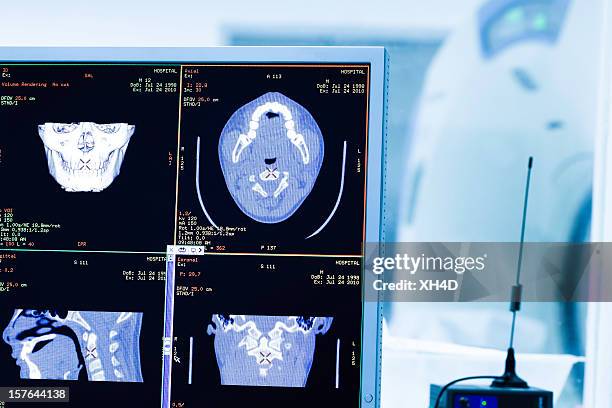 Small Bone Scan Machine Bone Scan Machine Photos and Premium High Res Pictures - Getty Images