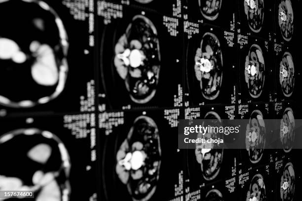 cat scan of human abdomen - abdomen xray stock pictures, royalty-free photos & images