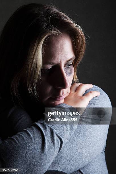 face of dispair: depressed woman with black eye - domestic violence stock pictures, royalty-free photos & images