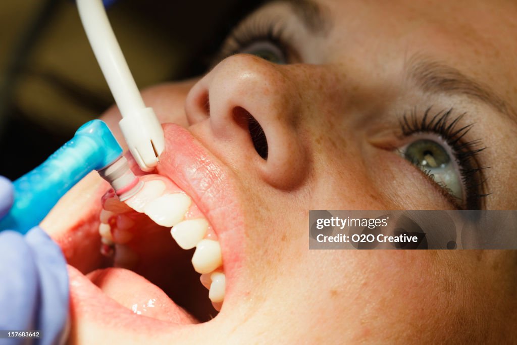 Dentista pulizia Close-up
