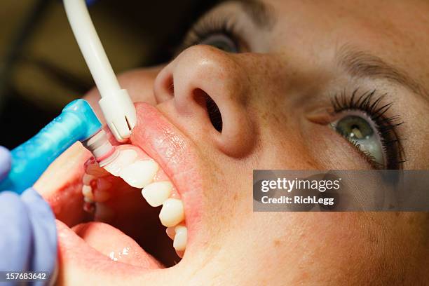 dental cleaning close-up - dental cleaning stock pictures, royalty-free photos & images