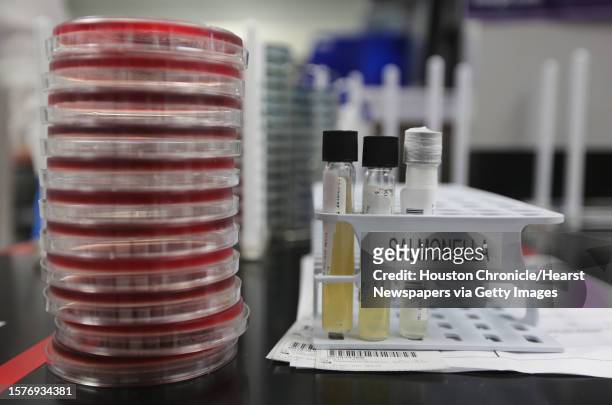 Agar plates with salmonella cultures ready for testing in the Medical Microbiology at the Houston Health and Human Services Department on Thursday,...