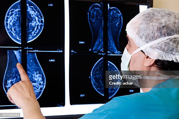 doktor blick magnetresonanztomographie - mammographie stock-fotos und bilder