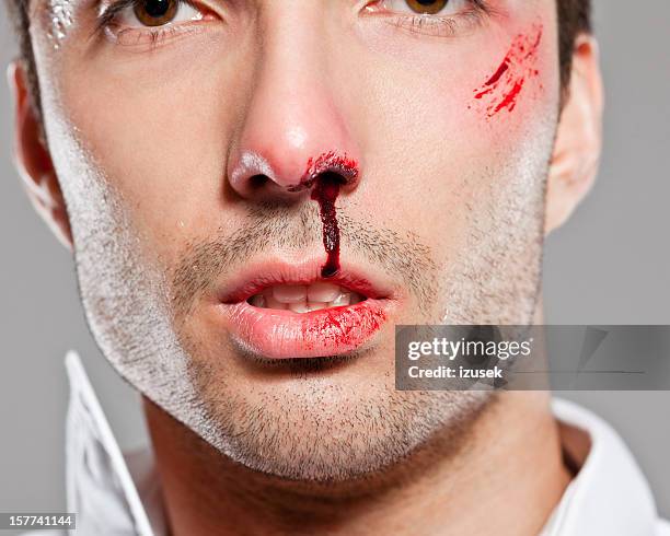 beaten man - head wound stock pictures, royalty-free photos & images