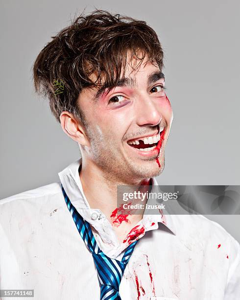 injured businessman - subdue stockfoto's en -beelden