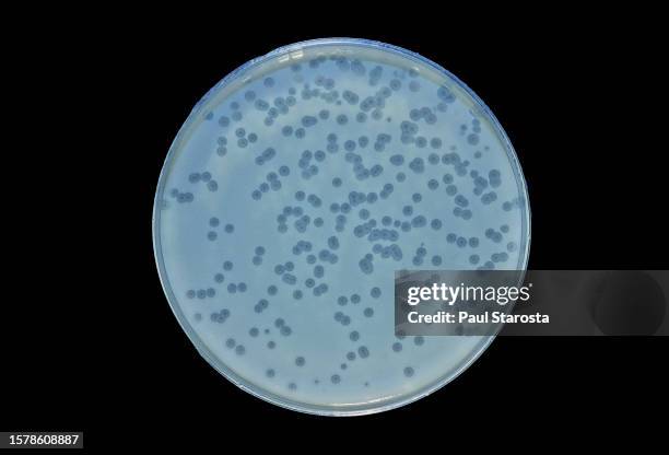 escherichia coli b - culture in the presence of a bacteriophage (t4) - maladie stock pictures, royalty-free photos & images