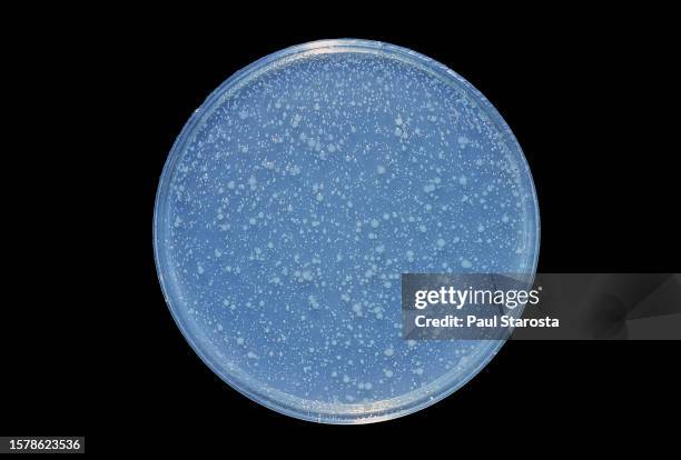 escherichia coli b - culture in the presence of an antibiotic (streptomycin) - partie d'une série stockfoto's en -beelden