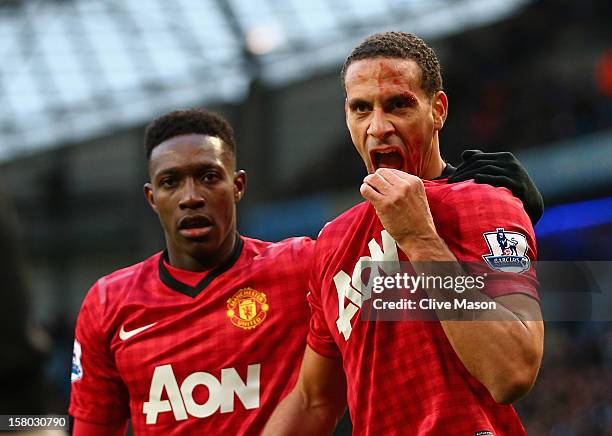 Rio Ferdinand of Manchester United is helped by team-mate Danny Welbeck after being struck by an object during the Barclays Premier League match...