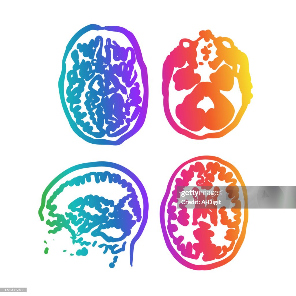Brain Scan Edrawing Brain Scan Image Rainbow High-Res Vector Graphic - Getty Images